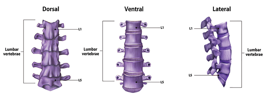 Bringing the lumbar spine into the correct position